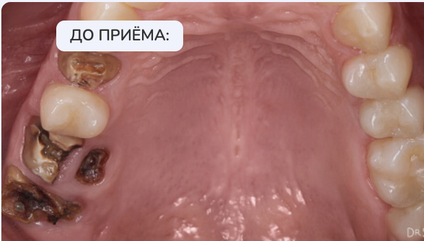 До