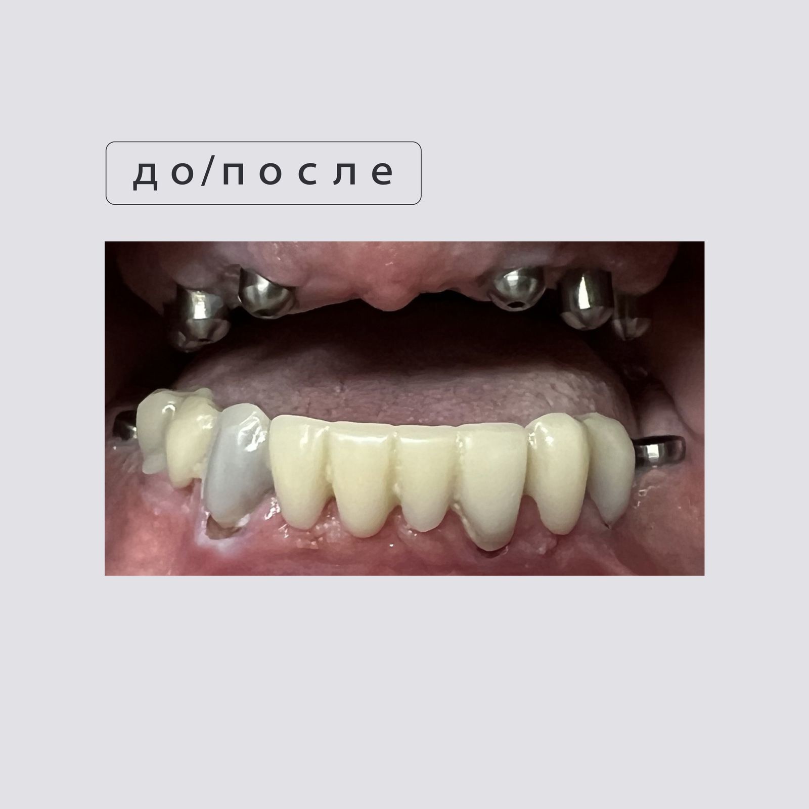 До