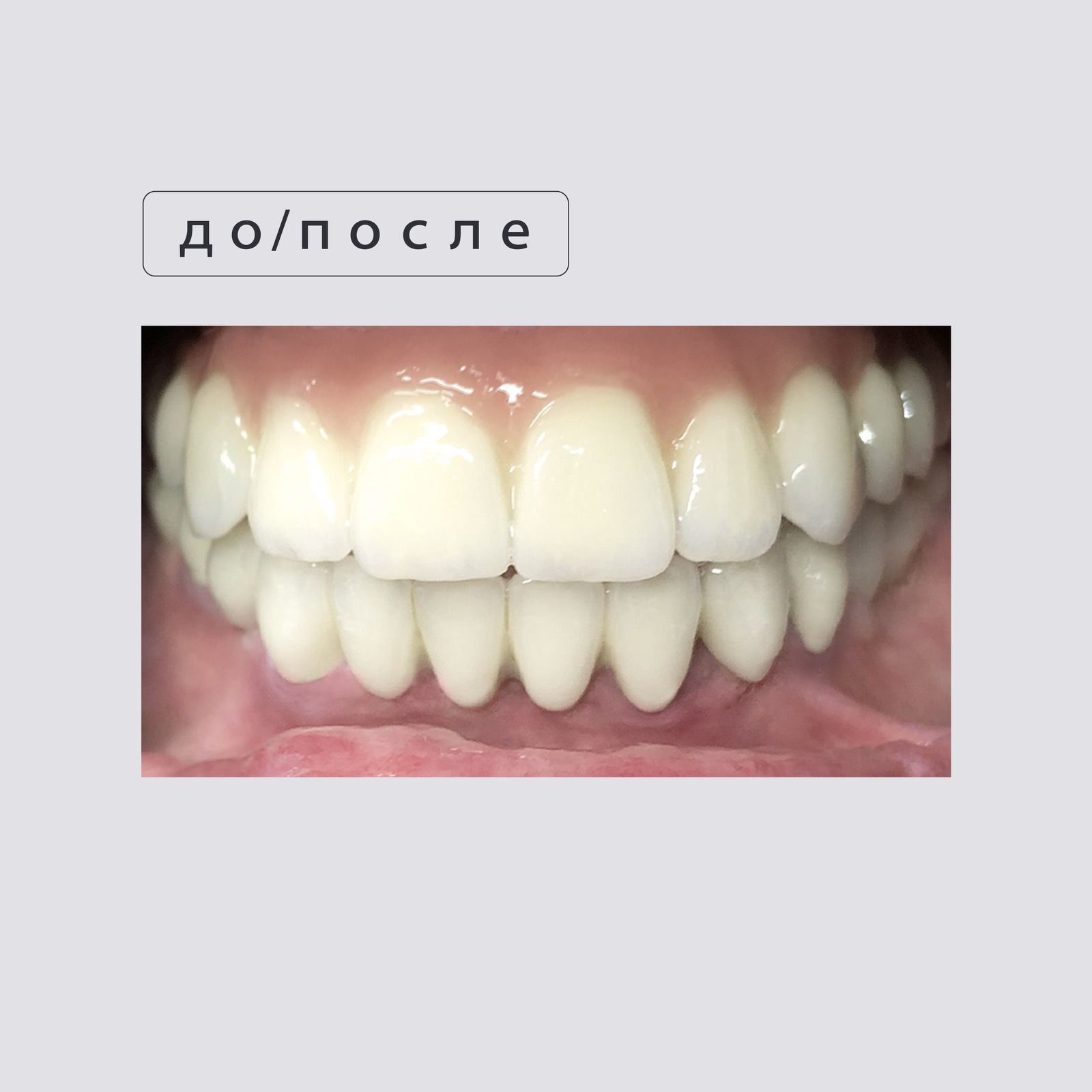 После
